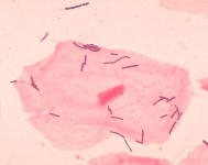 Lactobacillus Janice Carr