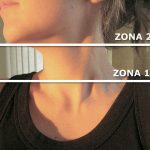 Cómo cuidar la piel del cuello, escote y barbilla