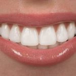 Irrigador dental portátil: 10 modelos a elegir y sus características