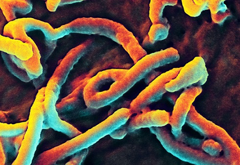 El ébola es una de las enfermedades emergentes